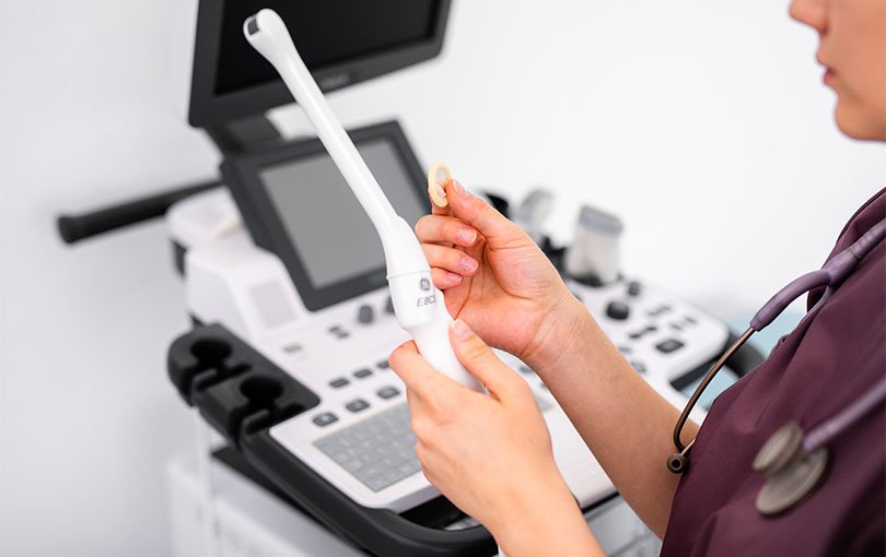 Sonda de ultrassom transvaginal segurada por médica ao lado do aparelho